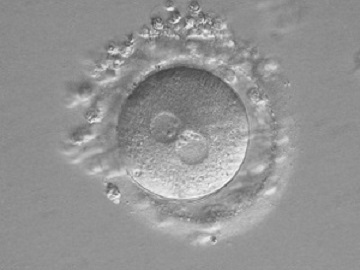 FIV con estudio cromosómico embrionario